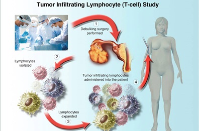 illustration of tumor infiltrating lymphocyte